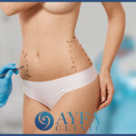 Liposuktion Türkei