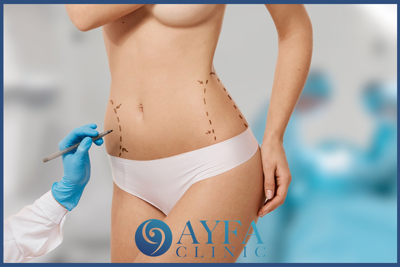 Liposuktion Türkei