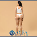 Gesäßästhetik Türkei