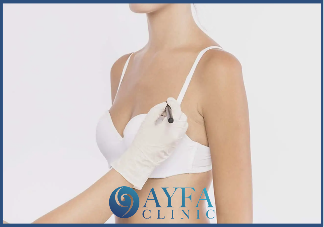 Brustverkleinerung Chirurgie Türkei