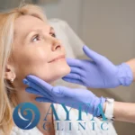 Stirnliftings in der Türkei