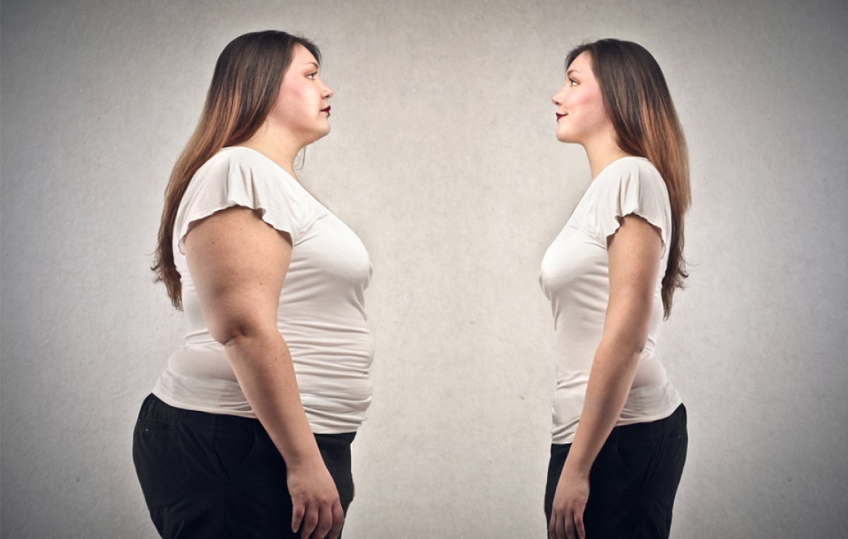 ¿Qué es la Cirugía de Obesidad?