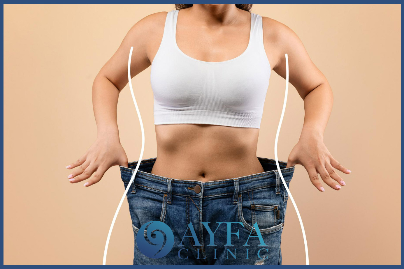 Precios de la Cirugía de Manga Gástrica en Turquía