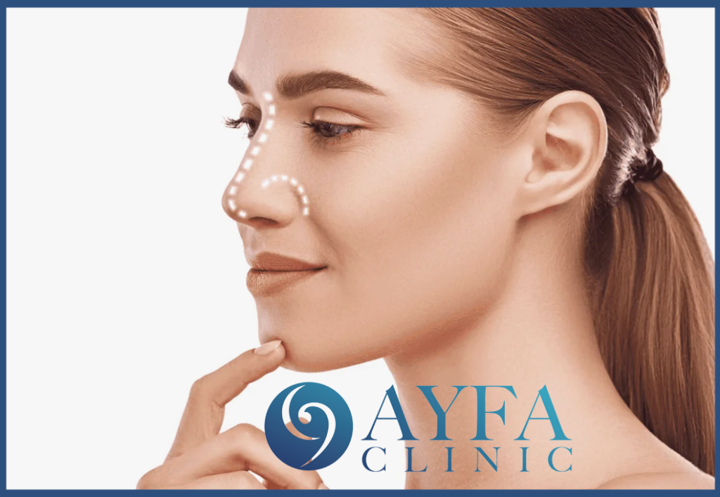 Rinoplastia (operación de nariz) en Turquía