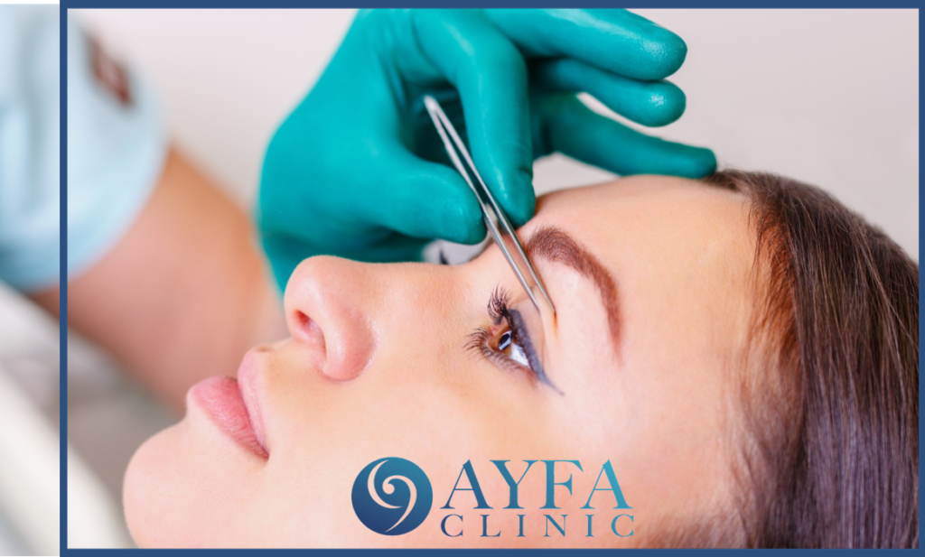 Estética de Párpados en Turquía