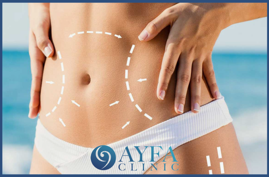 abdominoplastia en Turquía