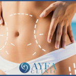 abdominoplastia en Turquía