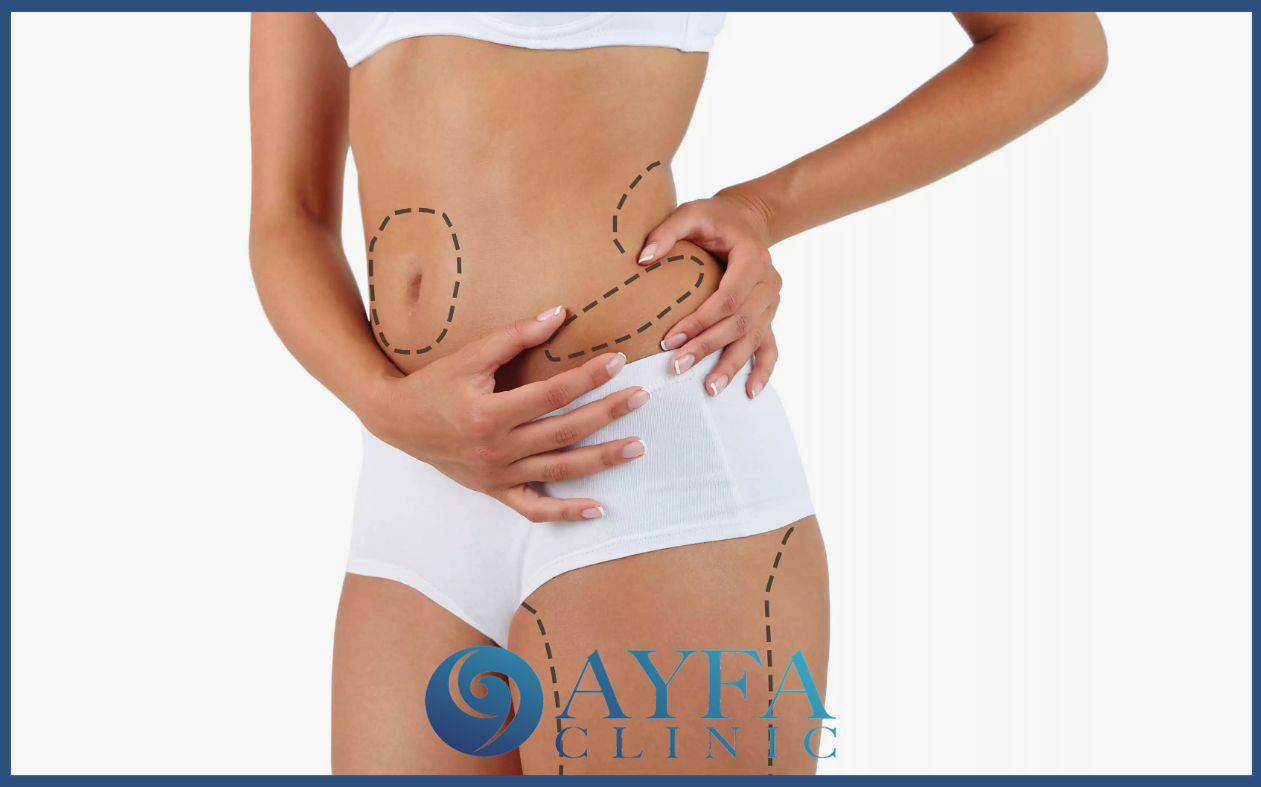 liposucción en Turquía