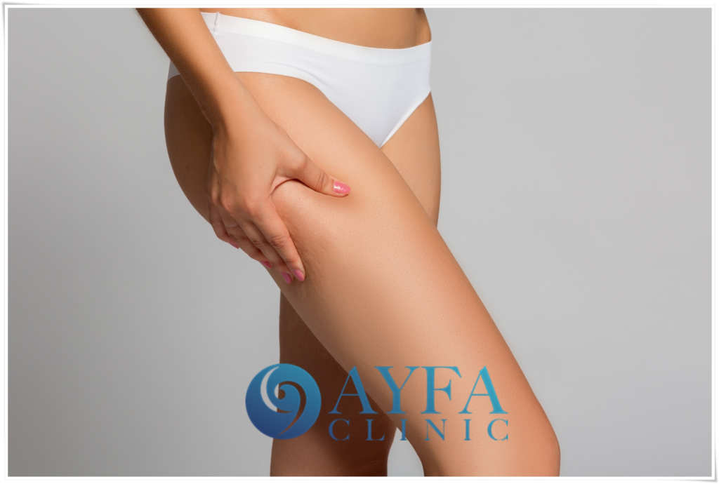 Cirugía de Lifting de Piernas en Turquía