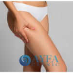 Cirugía de Lifting de Piernas en Turquía Cirugía de Lifting de Piernas en Turquía