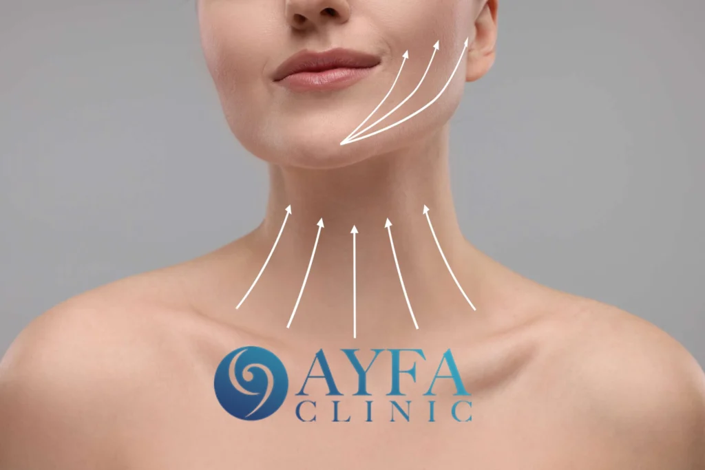 Cirugía de Lifting de Cuello en Turquía