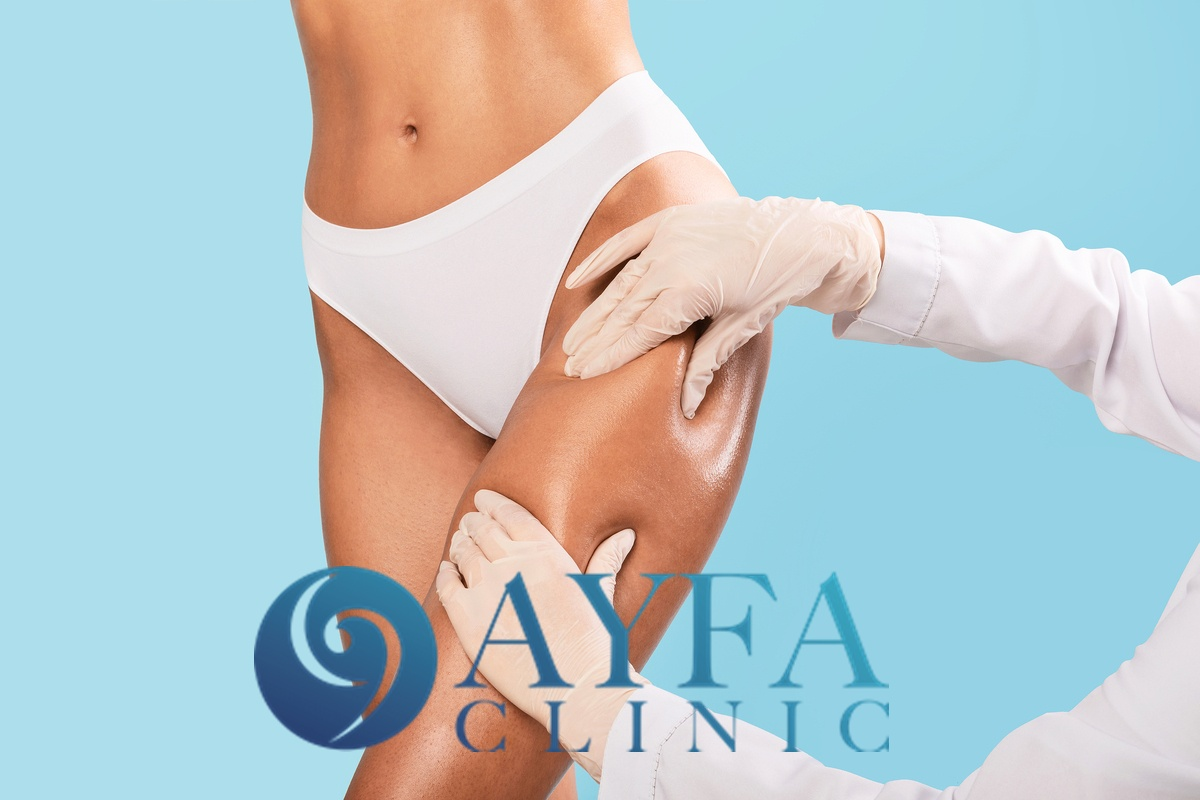 Estética de Glúteos (BBL – Lifting de Glúteos) en Turquía