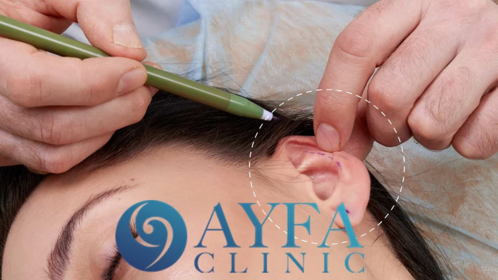 Cirugía de Otoplastia (Estética de Orejas) en Turquía