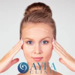 Cirugía de Lifting Facial en Turquía