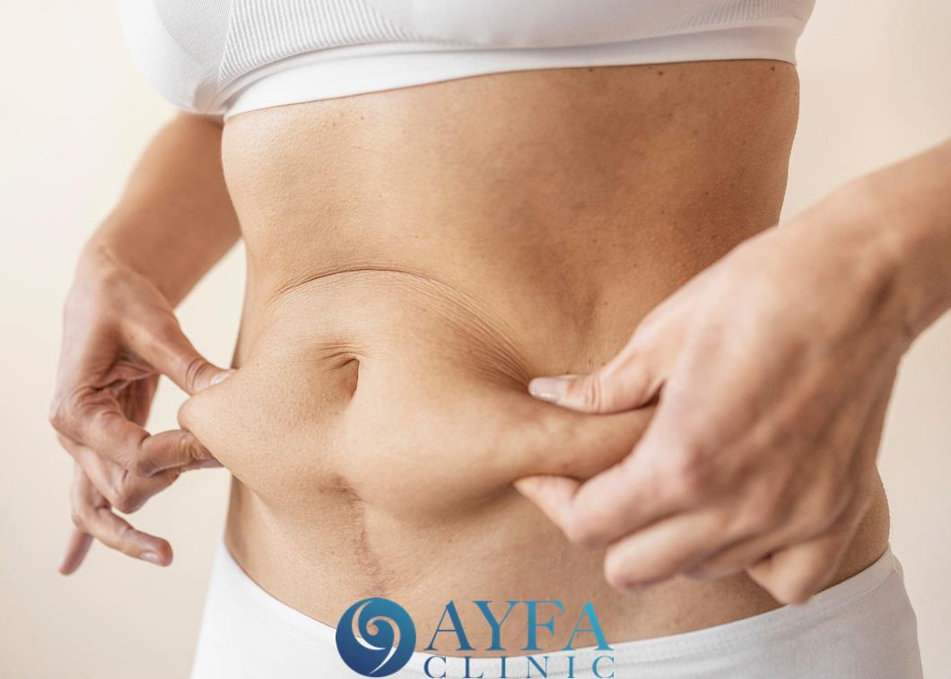 Mommy Makeover Aesthetics Prices In Turkey