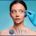 Eyelid Aesthetics Turkey