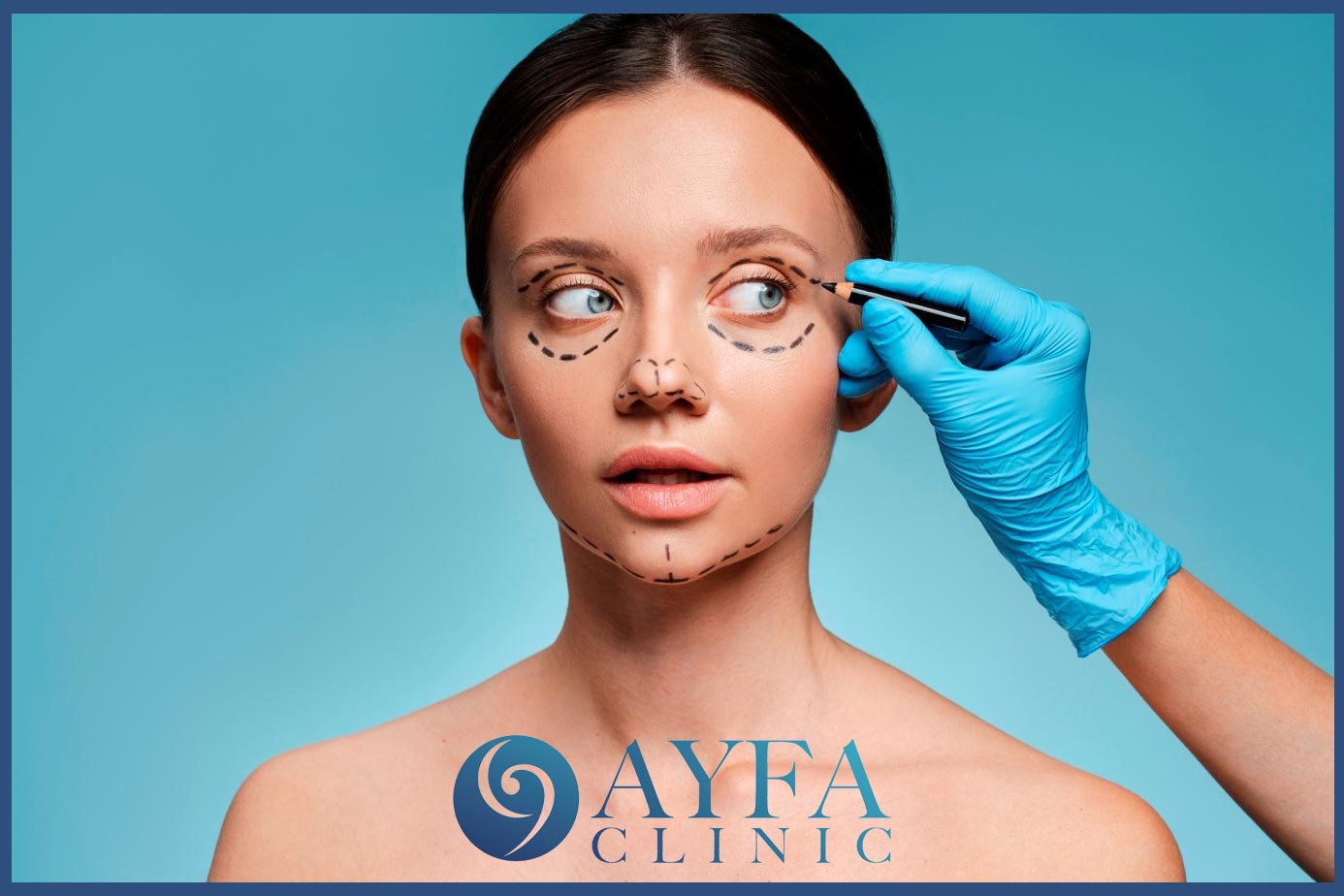 Eyelid Aesthetics Turkey