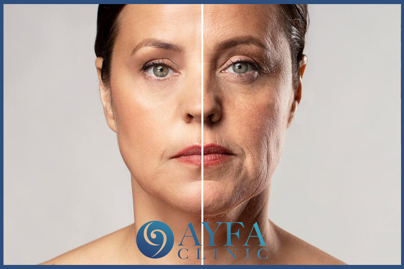 Face Lift Prices in Turkey