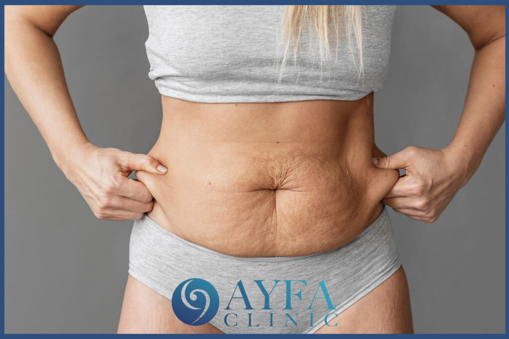 Türkiye'de Yağ Alma Ameliyatı Fiyatları