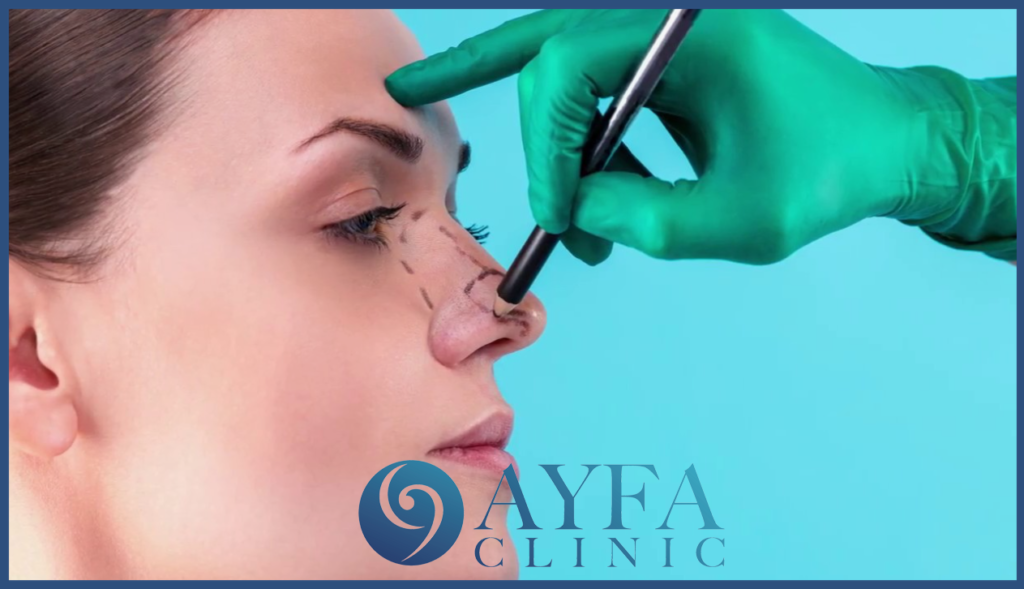 Die Rhinoplastik in der Türkei