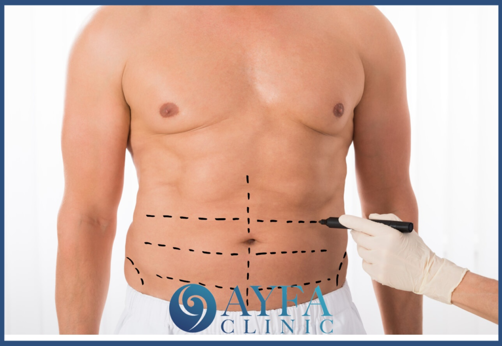 Aesthetic Surgeries for Men