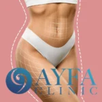 Hip aesthetics attracts attention because Turkey