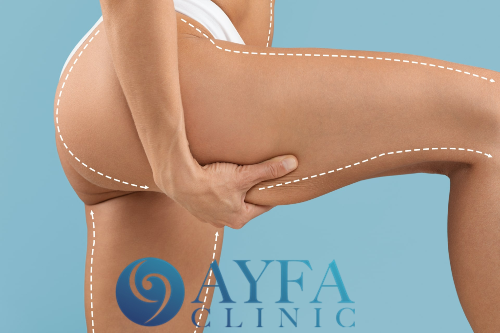 Thigh Lift Surgery Turkey