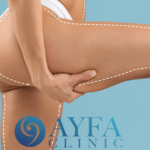Thigh Lift Surgery Turkey